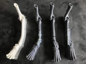 3D planning bone models with cutting and alignment guides