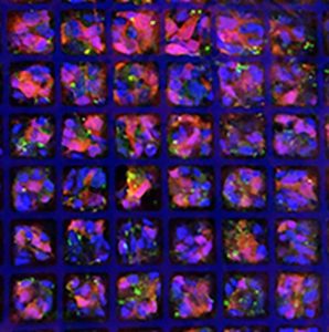 Photoreceptors grown from stem cells pack into a new ice cube tray-shaped scaffold to guide their development and implantation in patients’ eyes. COURTESY OF THE MA LAB